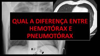 QUAL A DIFERENÇA ENTRE HEMOTÓRAX E PNEUMOTÓRAX [upl. by Geralda]