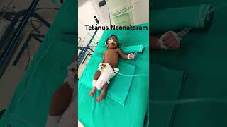 Tetanus in newborn is a fatal disease Tetanus neonatology [upl. by Lefton]