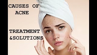 ACNE TREATMENT amp SOLUTIONS  RADIANCE CLINICS [upl. by Alema]