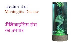 मैनिंजाइटिस रोग का इलाज  Treatment of Meningitis Disease Video 9 by Ayurveda amp Health [upl. by Sokul]