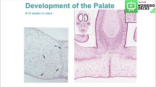 Oral EmbryologyPalatepart2 [upl. by Eadmund]