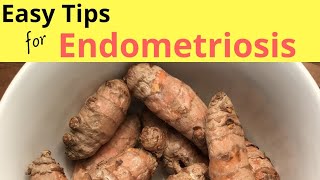 How to Cure Endometriosis Without Surgery  Home Remedies for Endometriosis [upl. by Nollaf611]