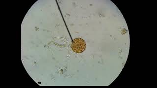 Ascaris lumbricoides hatching of egg [upl. by Kelda]