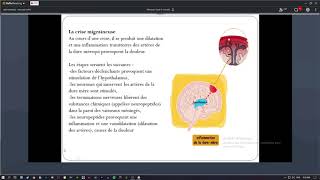 les algies craniofaciale [upl. by Mansoor909]