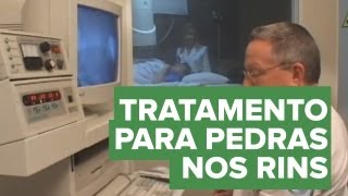 Tratamento do cálculo renal pedra nos rins  Educar para Prevenir Fundação PróRim [upl. by Myrtice]