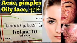 Isotane10 capsules uses in hindi [upl. by Gleich]