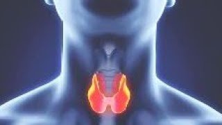 Hyperthyroidism فرط نشاط الغدة الدرقية [upl. by Noxid]