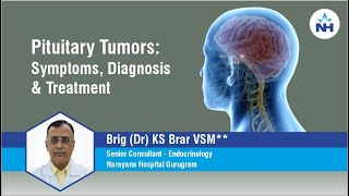 Pituitary Tumor  Symptoms Diagnosis and Treatment  Dr KS Brar [upl. by Neehar]