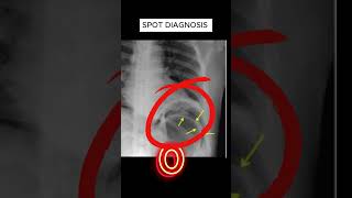 X ray quiz 37 nursing nursingstudent doctor USMLE MBBS hospital anatomy ctscan radiology [upl. by Neggem882]