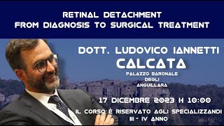 Ludovico Iannetti retinal detachment  from diagnosis ti surgical treatment  Seconda parte [upl. by Ayeki489]