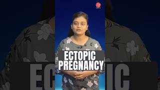 Ectopic Pregnancy by Ms Loveleen  NORCET 70 amp 80  NNL ONE  Nursing Next Live ectopicpregnancy [upl. by Kurzawa850]