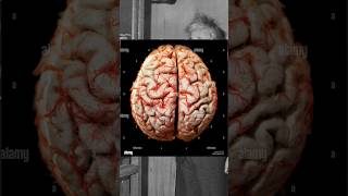 Facts about Albert Einstein brain and story viral Trend short FactsMine factsrv007 [upl. by Tsui]