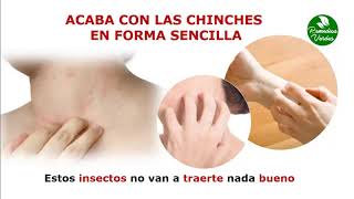 Como Acabar Con Las Chinches De Cama  como deshacerse de las chinches [upl. by Engle]