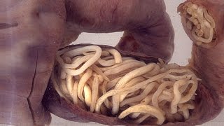 Top 10 Human Intestine Parasites Narrated [upl. by Phiona]