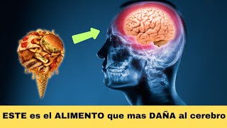 🔴 Como mantener un cerebro sano [upl. by Hewe]