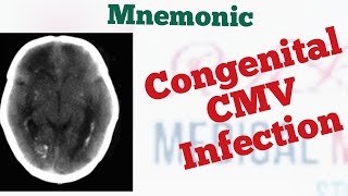 Congenital CytomegalovirusCMV triad Mnemonic [upl. by Noyahs]