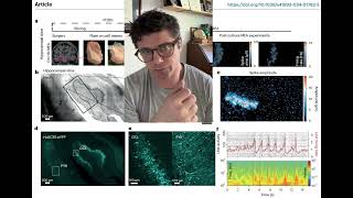 Human brain slice optogenetics figure 1 [upl. by Dedrick924]