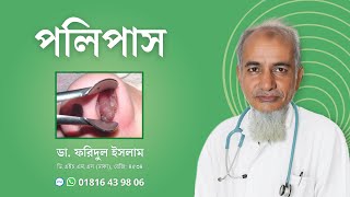 পলিপাস  Polyps  হোমিওপ্যাথি  নাকের পলিপাস দূর করার উপায়  Dr Faridul Islam [upl. by Ajim]