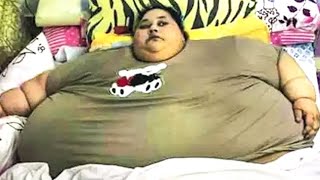 20 Fattest People in The World [upl. by Tabb]