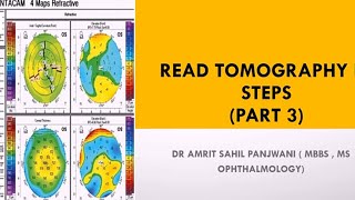 How to read corneal tomography printout  Pentacam [upl. by Kai]