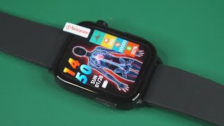 TK15  Blood Glucose Lipids Uric Acid Smart Watch  Unboxing Feature review link in description [upl. by Chelsea]