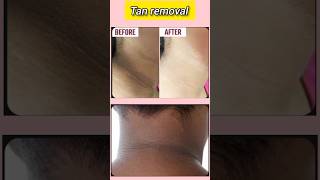 tan removal diy scrub diy [upl. by Nalaf]