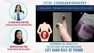 DETERMINING THE LATERALITY OF THE FETAL BODY AND IMAGE ORIEBTATION  FETAL ECHOCARDIOGRAPHY [upl. by Neelyad]