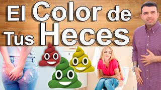 Qué Significa El Color De Tus Heces  Tus Heces Te Alertan Sobre Tu Salud  EN VIVO [upl. by Fleece]