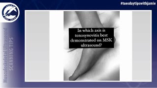 Scan technique for tendons with tenosynovitis in the tendon sheath [upl. by Hutson]