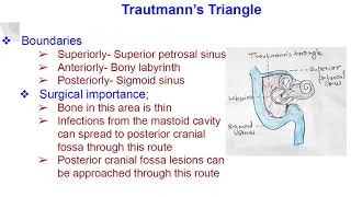 Trautmanns triangle [upl. by Leehar]