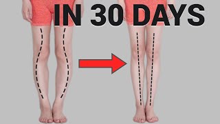 Get Straight Legs in 30 Days Fix O or XShaped Legs Knee Internal Rotation [upl. by Accever]