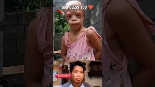 God bless 🙏❤️  Jesus Christ heal you shorts youtubeshorts ytshorts viral [upl. by Caldwell986]