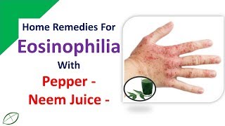 Home Remedies For Eosinophilia  Stop Eosinophilia With Pepper amp Neem Juice [upl. by Ycinuq491]