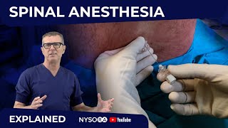 Spinal Anesthesia Explained Part 1 Crash course with Dr Hadzic [upl. by Damaris696]