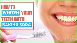 How to Whiten Teeth Instantly with Baking Soda Correct Procedure [upl. by Nomla]