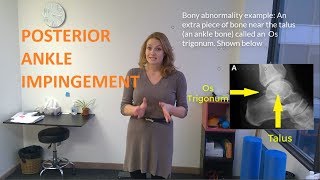 Posterior ankle impringement some intro exercises [upl. by Rebliw]