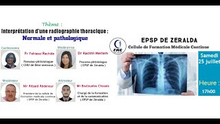 Webinaire  Interprétation dune radiographie thoracique  Pr Yahiaoui Rachida CHU de Benimessous [upl. by Avron]