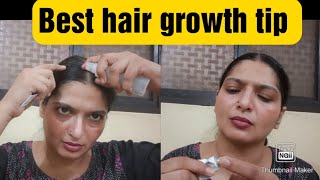 Best pharmacy product for hair growth hair growth tip new hair growth [upl. by Kalfas]