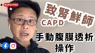 洗腎、腹膜透析大公開，湯姆叔叔親自手動操作CAPD示範＠致腎鮮師＠五分鐘搞懂管理學＠tomampnobody職場兒歌三百首＠五十六歲大叔創業進行式 [upl. by Aridnere315]