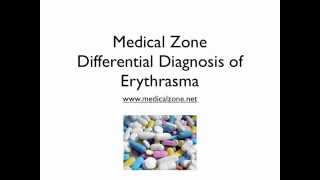 Medical Zone  Differential Diagnosis of Erythrasma [upl. by Naimed]