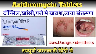 Zithrox 500 TabletsAzithromycin Tablets usesDosageSideeffects in hindiPharma with Vikram [upl. by Greenlee]