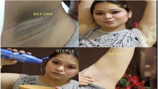 UNDERARMS WHITENING AT HOME100 EFFECTIVEINSTANT and FASTEST RESULT [upl. by Daeriam]