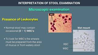 Interpretation of Stool Examination [upl. by Adnohsal]