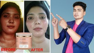 Nuskhe pigmentation cream by paras tomar  Review  Benefits and side effects [upl. by Ahtebbat]