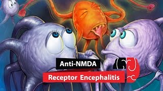 Anti NMDA Receptor Encephalitis [upl. by Nevarc]