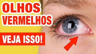 SEUS OLHOS FICAM VERMELHOS VEJA ISSO [upl. by Hayalat]