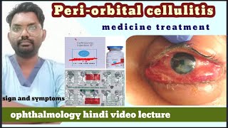 orbital cellulitis  orbital disease  orbital cellulitis  orbitalcellulitismedicinetreatment [upl. by Samid107]