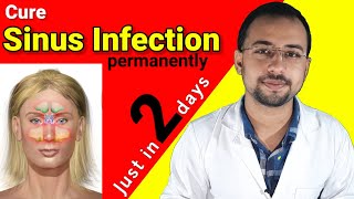 Cure sinus infection just in 2 days naturally  Sinusitis treatment home tips  sinus symptoms [upl. by Lyman]