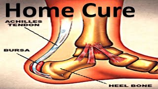 Heel Bursitis amp Achilles Tendon Bursitis Best HOME Treatment [upl. by Sigfried]