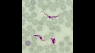 Aula 5 Trypanosoma [upl. by Euqinot712]